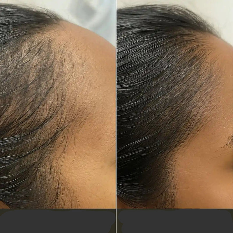 Escova TheraBrush Capilar 4 em 1 – Estimula, massageia e revitaliza os cabelos