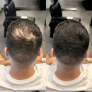 Camuflagem Capilar Profissional → Apex Hair® – Disfarça falhas e afinamento com cobertura natural