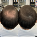 Camuflagem Capilar Profissional → Apex Hair® – Disfarça falhas e afinamento com cobertura natural