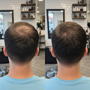 Camuflagem Capilar Profissional → Apex Hair® – Disfarça falhas e afinamento com cobertura natural