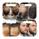 Camuflagem Capilar Profissional → Apex Hair® – Disfarça falhas e afinamento com cobertura natural