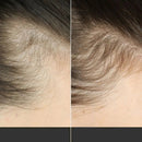 Escova TheraBrush Capilar 4 em 1 – Estimula, massageia e revitaliza os cabelos