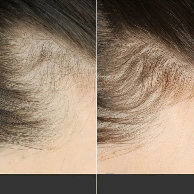 Escova TheraBrush Capilar 4 em 1 – Estimula, massageia e revitaliza os cabelos
