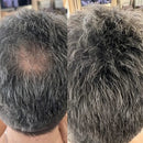 Camuflagem Capilar Profissional → Apex Hair® – Disfarça falhas e afinamento com cobertura natural