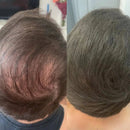 Camuflagem Capilar Profissional → Apex Hair® – Disfarça falhas e afinamento com cobertura natural