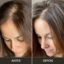 Aparelho de Alta Frequência para Tratamento Capilar e Facial → Derma Capilar™ – Tratamento profissional para cabelos mais fortes e pele revitalizada