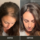 Aparelho de Alta Frequência para Tratamento Capilar e Facial → Derma Capilar™ – Tratamento profissional para cabelos mais fortes e pele revitalizada
